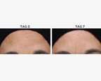 Age Spot Cream Serum 30 ml